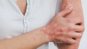 Skin Therapy Research Unit